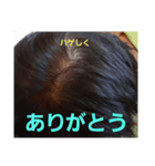 ハゲしすぎる男（個別スタンプ：6）