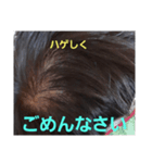 ハゲしすぎる男（個別スタンプ：7）