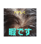 ハゲしすぎる男（個別スタンプ：13）